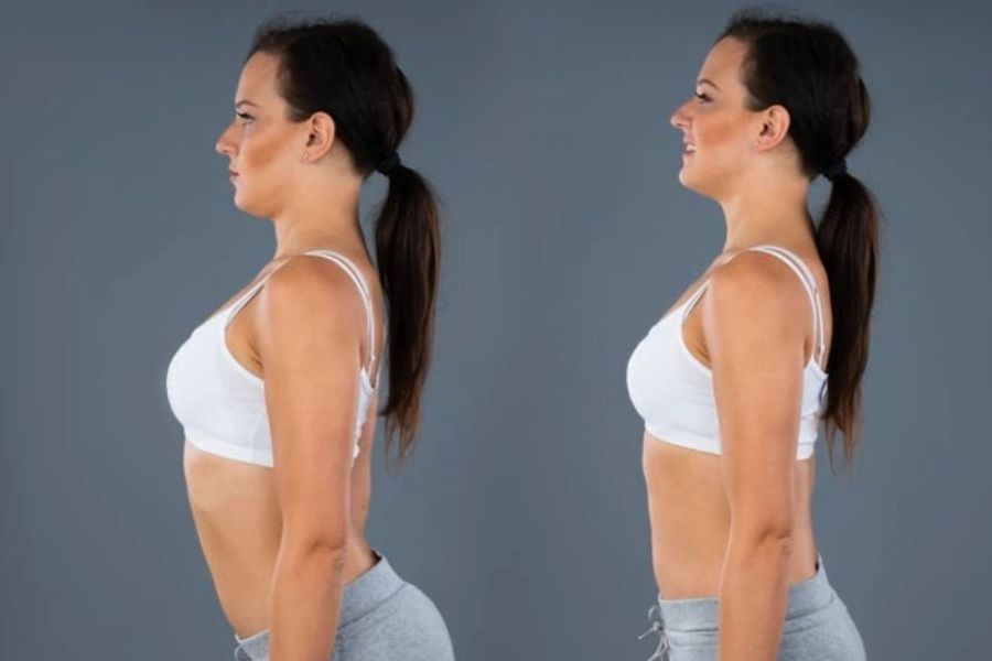 Tìm hiểu thông tin về võng lưng và nguyên nhân để khắc phục hiệu quả